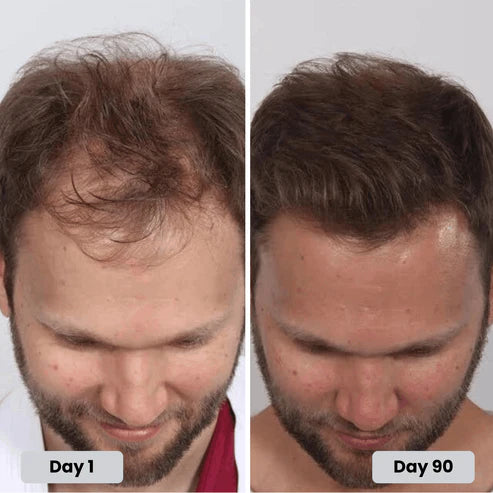 Red light therapy hat for healthy hair treatment